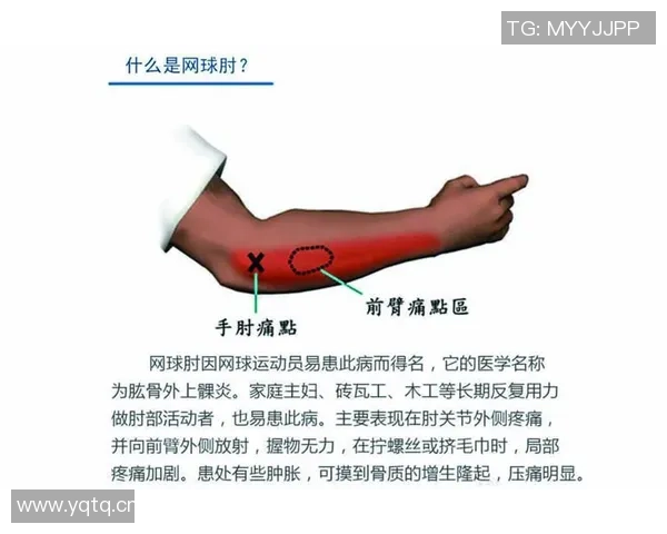 广州网球队进攻策略分析与战术解读助力网球热点发展